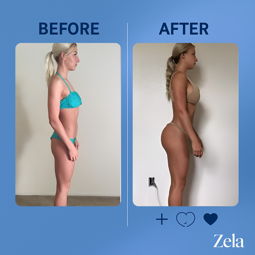 Zela® Gummies Combo Pack
